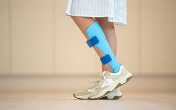 Calzature ortopediche escluse dai rimborsi