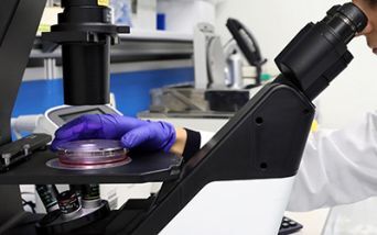 Esame diagnostico Malattia di Still