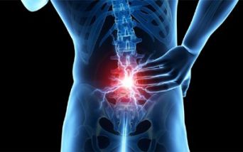 Dolore lombo-sacrale