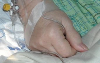 Infusione endovenosa