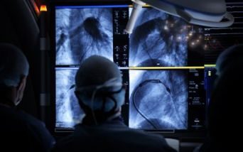 Intervento chirurgico in paziente con cardiopatia congenita