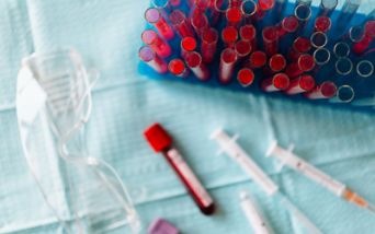 COVID-19 e mieloma multiplo