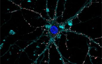 Modello sperimentale di retina liquida