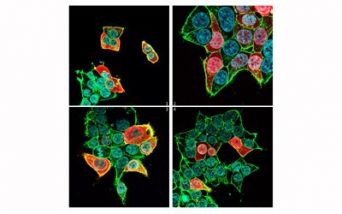 Mutazione del gene MAPK1