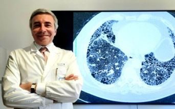 Fibrosi polmonare, il punto con il prof. Richeldi