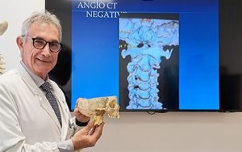 Testa che scivola sul collo: il punto con il professor Visocchi