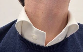 Tumore alla gola: l'importanza della prevenzione