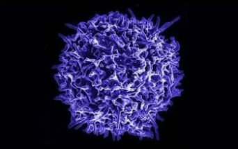 Linfocita T (o cellula T)