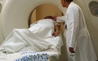 Tumore alla prostata nuovi studi