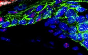 Fotografia di cellule della pelle