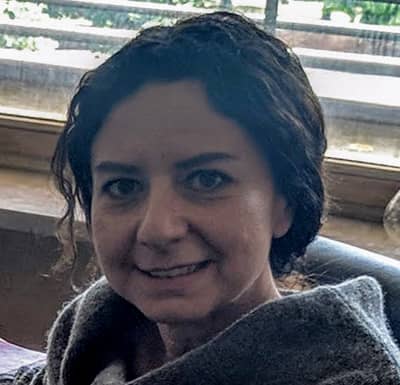 craniosinostosi, dottoressa Wanda Lattanzi