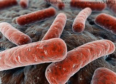 malattia polmonare da micobatteri non tubercolari, Mycobacterium avium complex