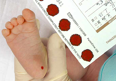 Procedura di screening neonatale