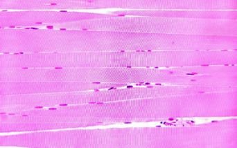 Tessuto muscolare scheletrico striato