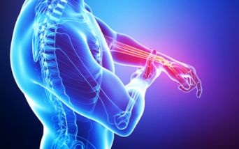 Sindrome del tunnel carpale